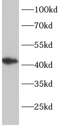 ELK3 antibody|ELK3抗体
