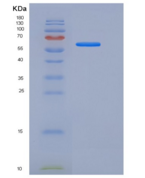 人CD55 / DAF重组蛋白Fc tag