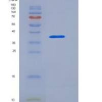 人组织蛋白酶B(CTSB)重组蛋白His tag