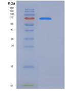 小鼠TrkA / NTRK1重组蛋白Fc tag