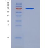 小鼠Coagulation Factor II / FII / F2重组蛋白His tag