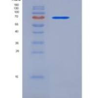 小鼠Coagulation Factor II / FII / F2重组蛋白His tag