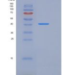小鼠ACVR2A / ActrIIa重组蛋白His & Fc tag