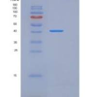 小鼠ACVR2A / ActrIIa重组蛋白His & Fc tag