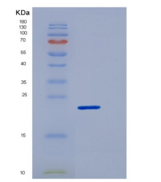 人髓细胞触发受体1(TREM1)重组蛋白His tag