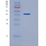 人CD97分子(CD97)重组蛋白His tag