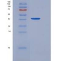 人CD97分子(CD97)重组蛋白His tag