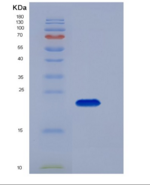 小鼠CD48重组蛋白His Tag
