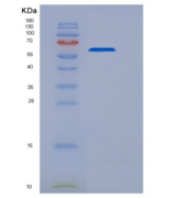 人磷脂酰肌醇蛋白聚糖5(GPC5)重组蛋白His tag