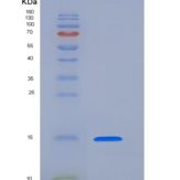 人PHPT1 / PHP14重组蛋白His tag