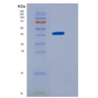 人组织蛋白酶D(CTSD)重组蛋白His tag