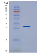 人B7-H6重组蛋白His Tag