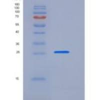 小鼠Trypsin 2 / PRSS2重组蛋白His tag