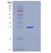 人Syndecan-1 / SDC1 / CD138重组蛋白