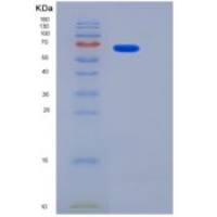 人DC-SIGNR / CD299 / CLEC4M重组蛋白Fc tag