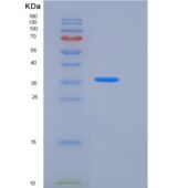 人PTPN2 / PTPT重组蛋白