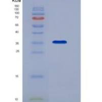 小鼠CD123 / IL3RA重组蛋白ECD, His tag