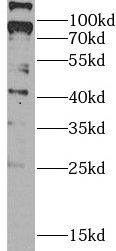 MAS1 antibody|MAS1抗体