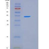 人ALK4 / ACVR1B重组蛋白His & Fc tag