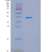 人ALK4 / ACVR1B重组蛋白His & Fc tag