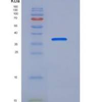 人Cathepsin L1 / CTSL1重组蛋白His tag