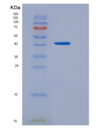 人CD97分子(CD97)重组蛋白His tag
