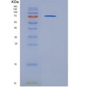 人CD45 / PTPRC重组蛋白Fc tag