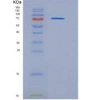 人CD45 / PTPRC重组蛋白Fc tag