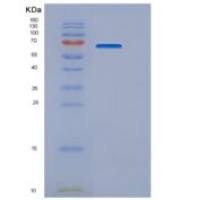 小鼠EGF样域半胱氨酸丰富蛋白1(CRELD1)重组蛋白ECD, Fc Tag