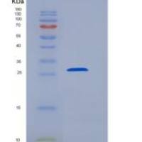 人B7-H6重组蛋白His Tag
