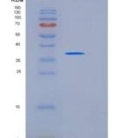 人组织蛋白酶S(CTSS)重组蛋白His tag