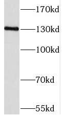 PPP2R3A antibody|PPP2R3A抗体