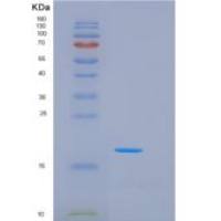 人NKG2D重组蛋白aa 78-216, His Tag