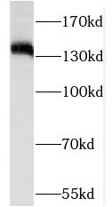 ROR1 antibody|ROR1抗体