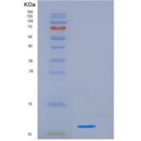 人S100钙结合蛋白A10(S100A10)重组蛋白His tag