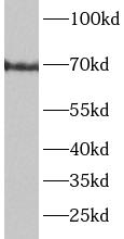 CTSC antibody|CTSC抗体