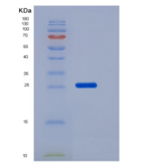 小鼠Coagulation Factor III / Tis