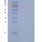 人Defensin / Beta-defensin 3 / DEFB103重组蛋白His tag