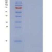人Defensin / Beta-defensin 3 / DEFB103重组蛋白His tag