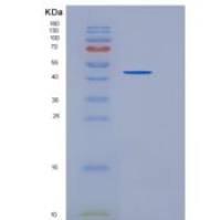 小鼠CEACAM1 / CD66a重组蛋白His tag