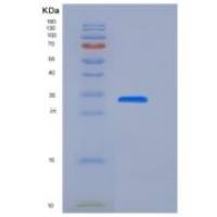 小鼠IL17BR / IL17RB / IL-17 Receptor B重组蛋白His tag