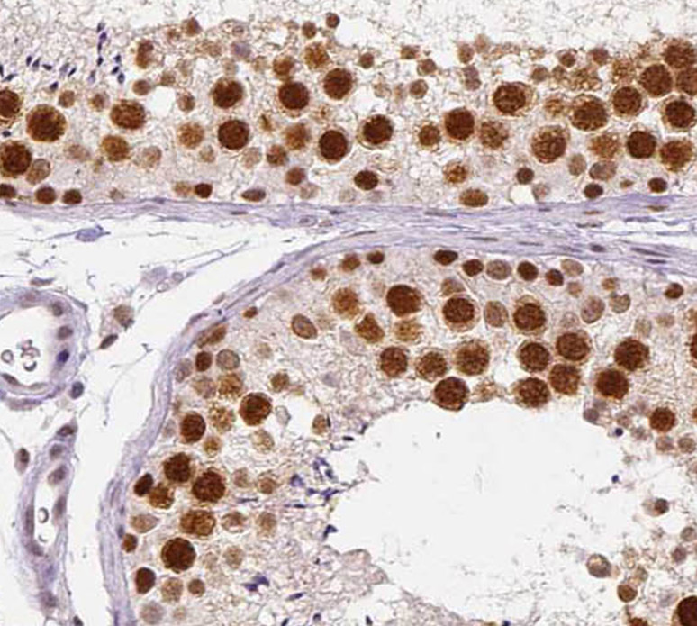 SPANXD antibody|SPANXD抗体