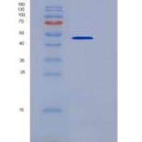 小鼠THSD1 / TMTSP重组蛋白His tag