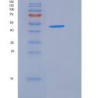 人RAC1 / MIG5重组蛋白GST tag