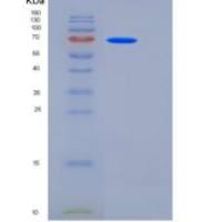 人CEACAM5 / CD66e重组蛋白His tag
