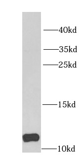 DBI antibody|DBI抗体