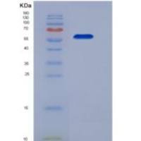 人PDGFRB / PDGFR-1 / CD140b重组蛋白