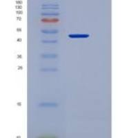 小鼠TIM3 / HAVCR2重组蛋白Fc tag