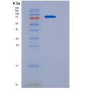 小鼠LIFR / CD118重组蛋白His tag