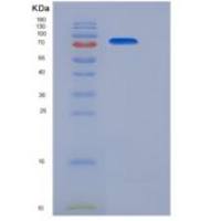 小鼠LIFR / CD118重组蛋白His tag